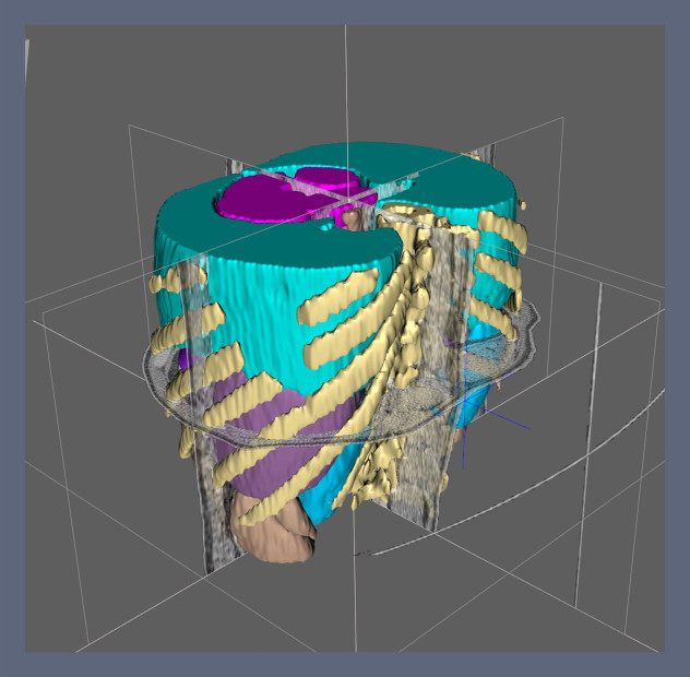 AI-assisted segmentation screen