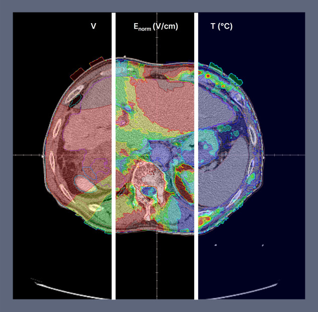 Simulation result visualization screen