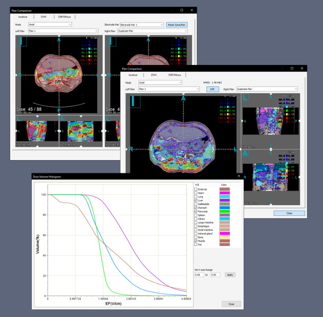 VOI analysis and metric comparison screen