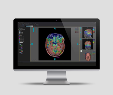 OncoField Lab interface preview