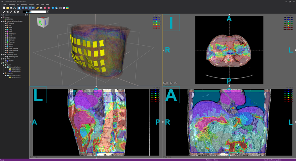 OncoField Lab interface preview